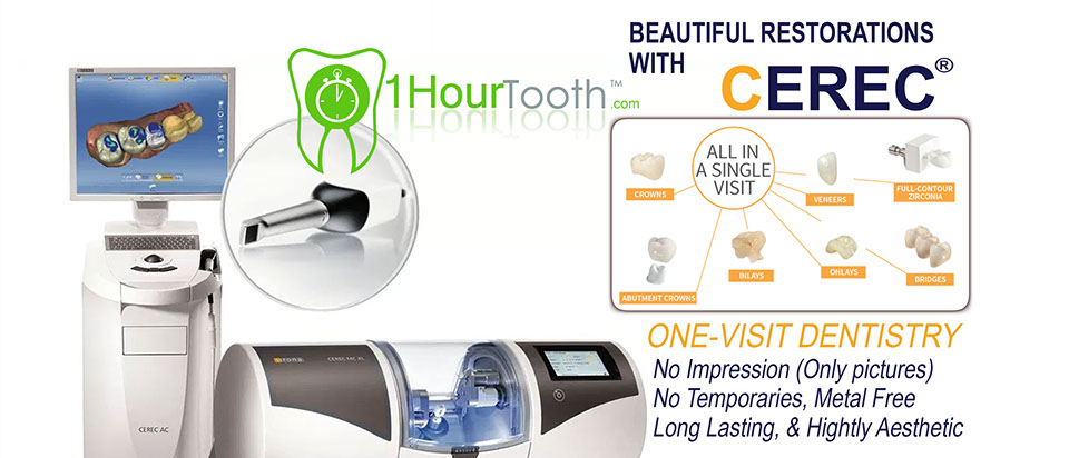We have the CEREC technology, photo feature our ability in making Crowns, inlays, onlays in less than 1 hour. Better material, better technology